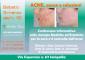 Acne: cause e soluzioni